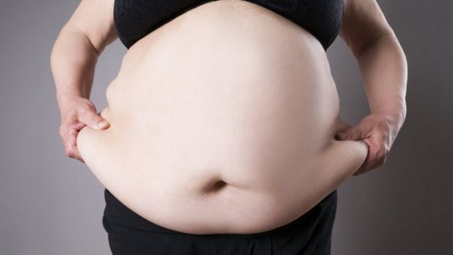 “Las personas gordas llevamos mucho tiempo sufriendo violencia en silencio”