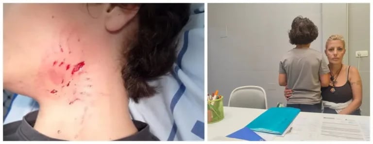 Un pitbull se lanza al cuello de un niño de diez años en la vivienda donde alquila una habitación