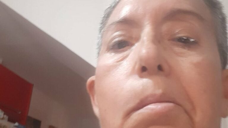 Una vecina de Gran Tarajal denuncia el abandono sanitario tras sufrir una parálisis facial